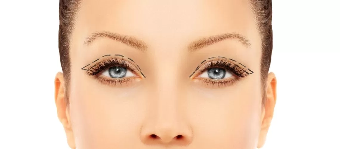 Blepharoplasty Abroad