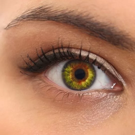 Canthoplasty 1 jpg