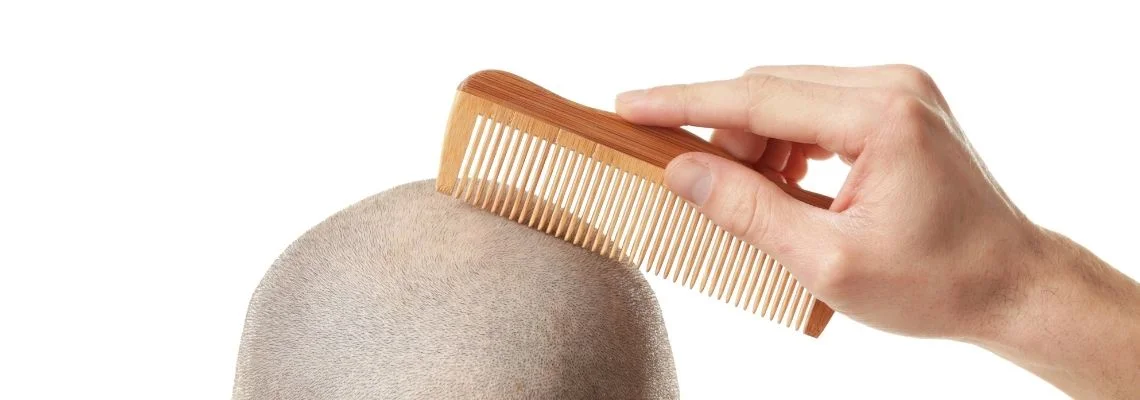 HAIR TRANSPLANT