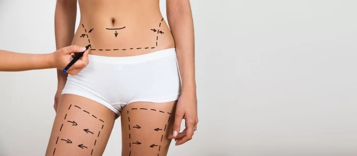 Liposuction Abroad