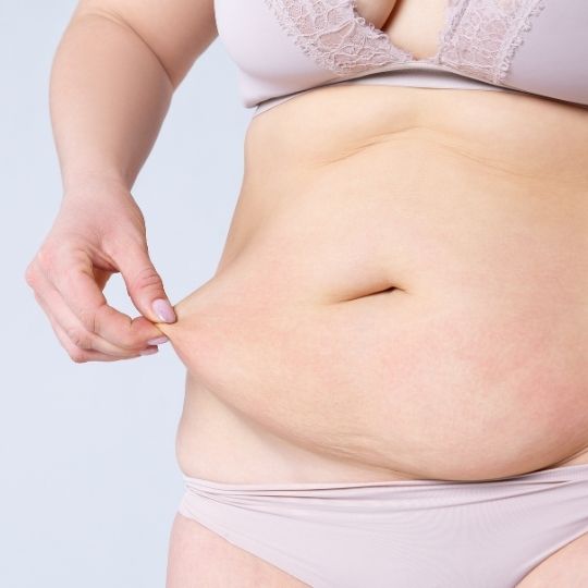 Post Bariatric Plastic Surgery in Turkey