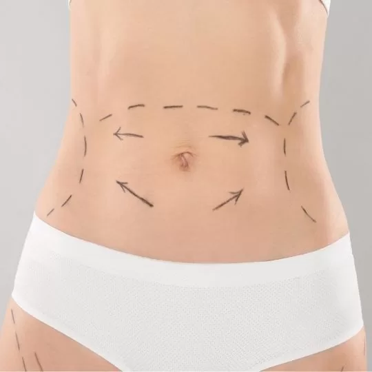 Vaser Liposuction jpg